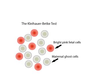 Kleihauer–Betke test .